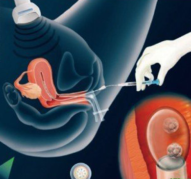網(wǎng)友的血淚史：做試管嬰兒必經(jīng)的7個(gè)坎
